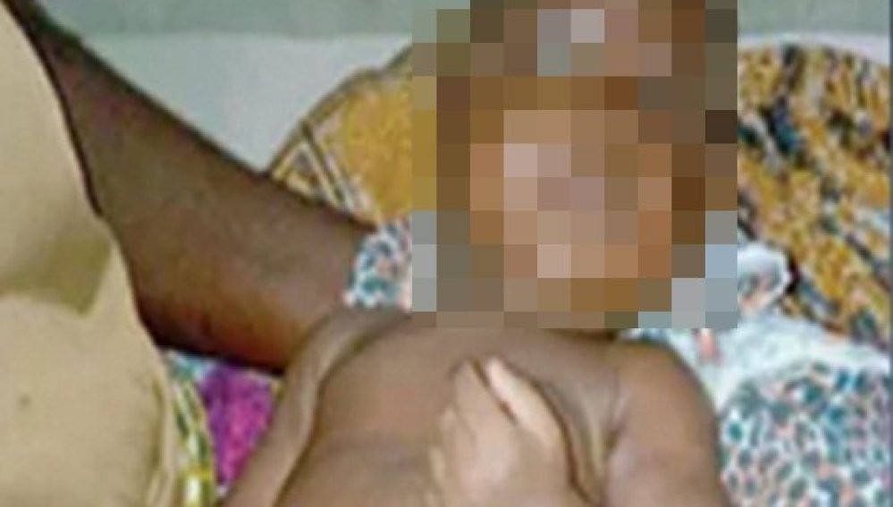 Murió el bebé al que su madrastra le cortó el pene con un cuchillo cuando tenía dos meses | Internacionales