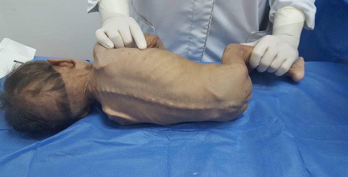 Diputado venezolano reportó la muerte por desnutrición de un niño | Internacionales