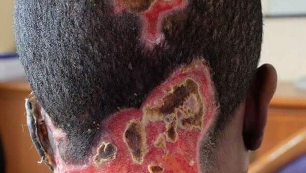 La mujer que quedó ciega, sin hablar y con dificultades para comer tras ser atacada con ácido | Internacionales