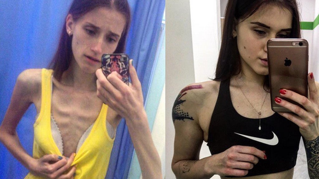 La joven que se recuperó de la anorexia y se convirtió en gurú del fitness en Instagram | Redes