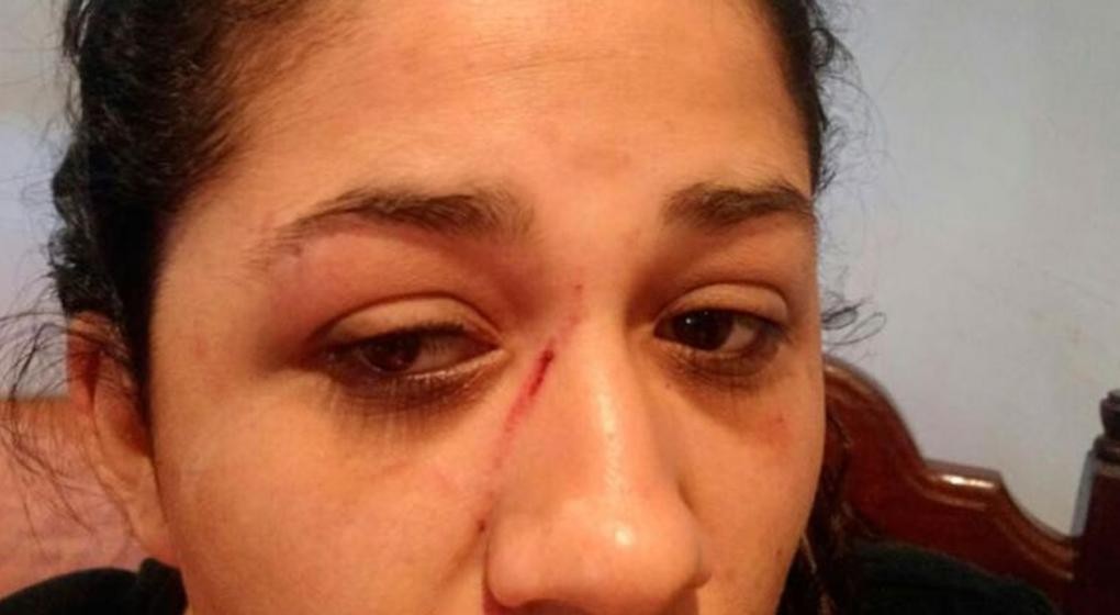 Una mujer recibió un botellazo en medio de una discusión de tránsito, le dieron 25 puntos | Actualidad