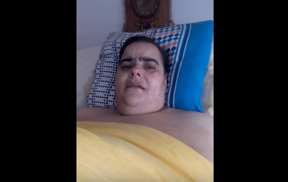Una mujer obesa pide ayuda: necesita atención en un centro sanitario especializado | Actualidad