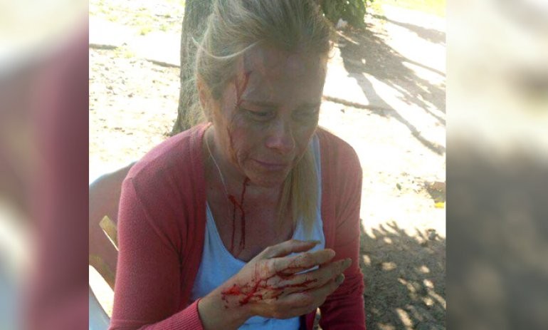Fue al cementerio a visitar la tumba de su mamá, quisieron robarle y la agredieron brutalmente | Actualidad