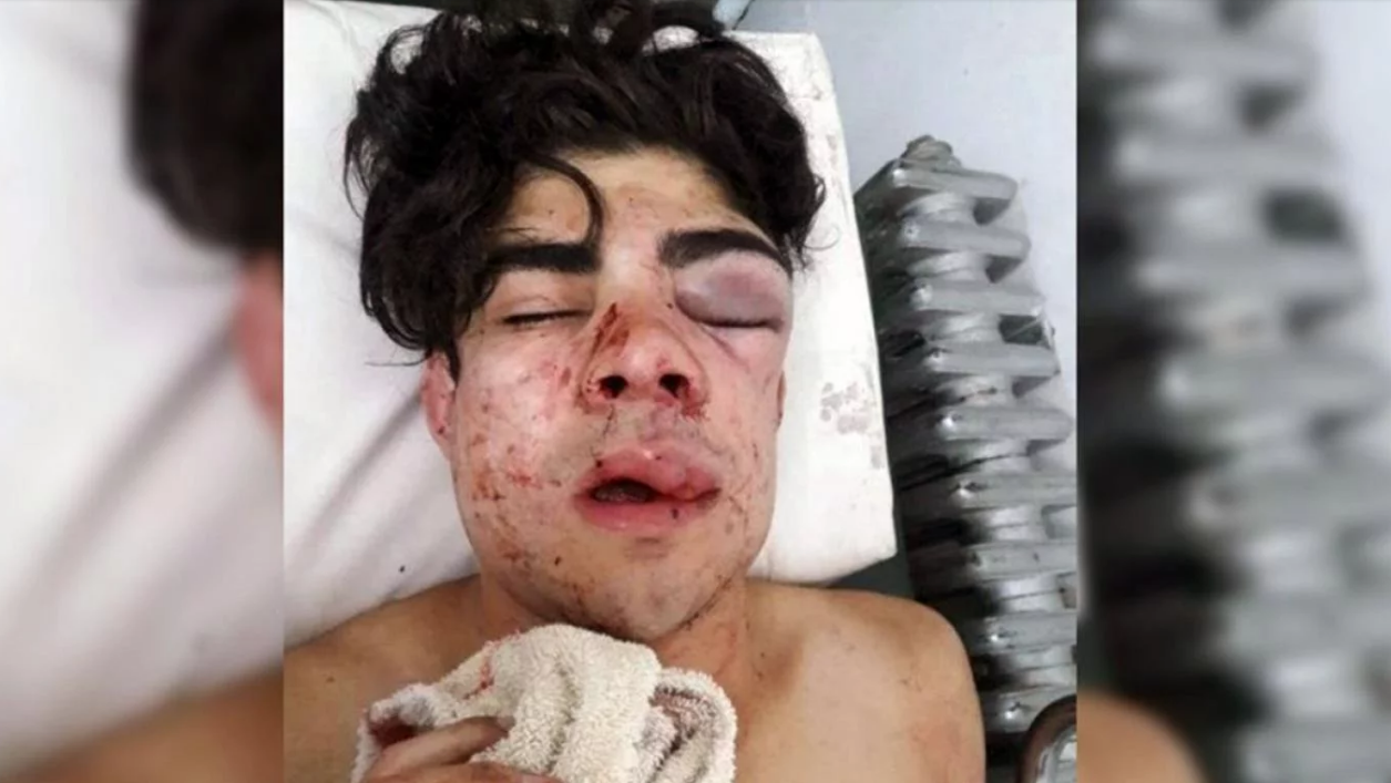Golpearon brutalmente a un joven porque creyeron que era chileno | Actualidad