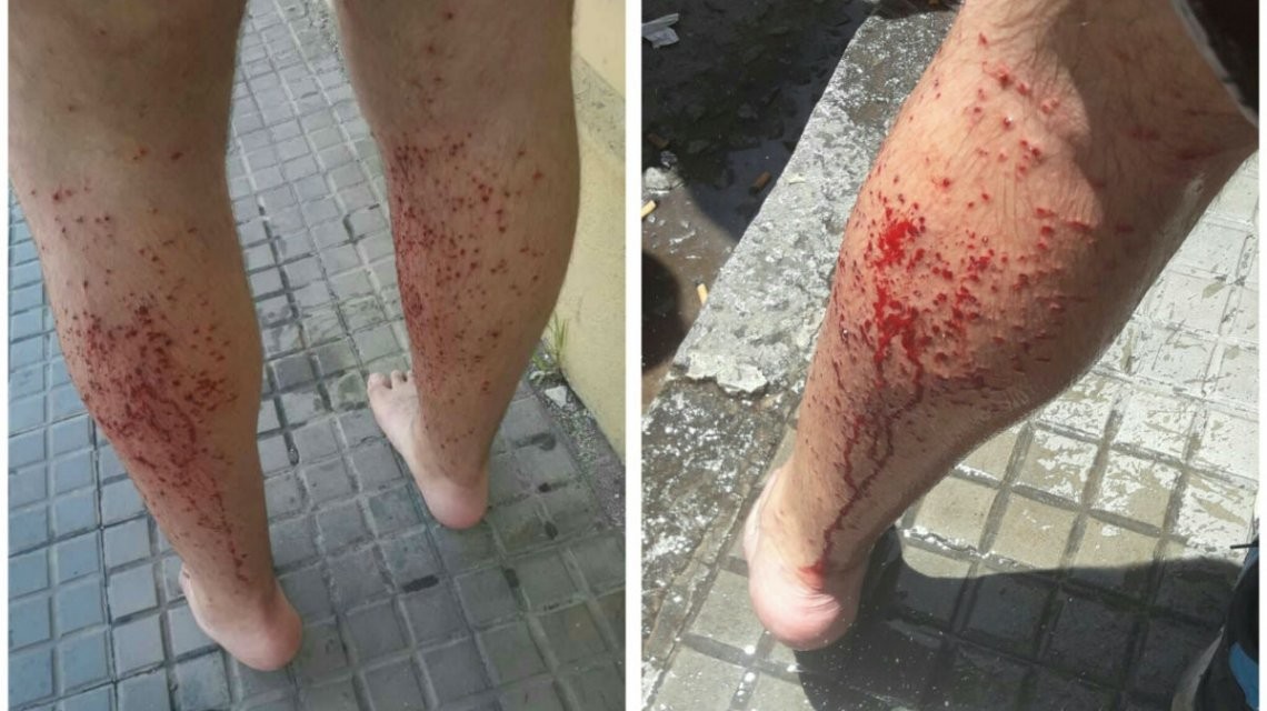 Catamarca: policía disparó con balas de sal a chicos que festejaban el fin del ciclo lectivo | Actualidad