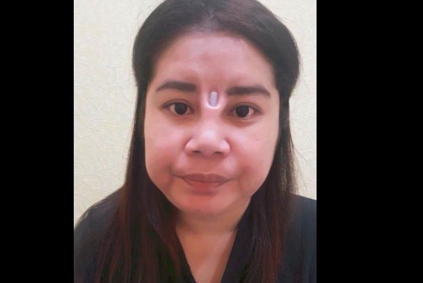 Impactantes fotos: denuncia que una operación plástica fallida le dejó un agujero entre los ojos | Redes
