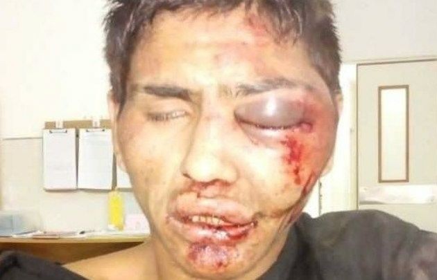 Robó un celular y le desfiguraron la cara a golpes | Actualidad