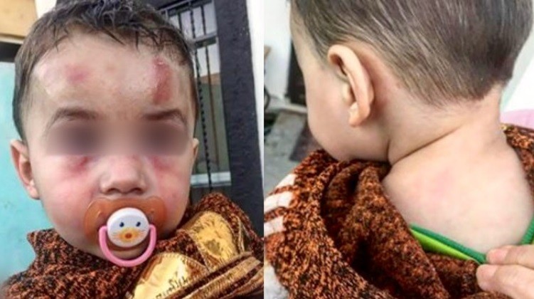 Horror en México: un bebé fue brutalmente golpeado en una guardería | Internacionales