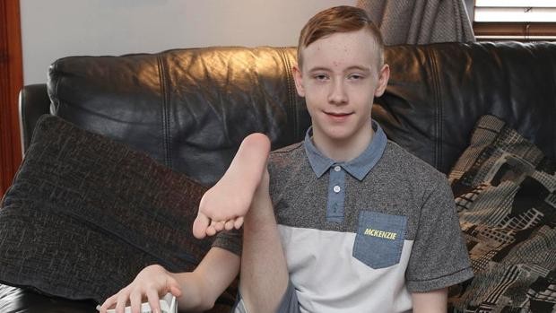 El joven que sueña con jugar al fútbol, pese a que le colocaron el pie al revés por un cánce | Internacionales