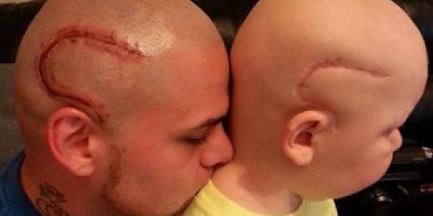La conmovedora carta de despedida de padre que se tatuó en la cabeza la cicatriz que tenía su hijo | Redes