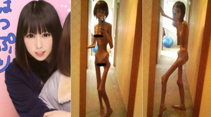 El calvario de la joven japonesa que fue torturada por su abuelo y llegó a pesar 16 kilos | Internacionales
