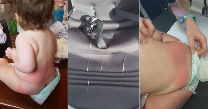 Conmoción en Francia: atacaron con ácido a una bebé de 14 meses | Internacionales