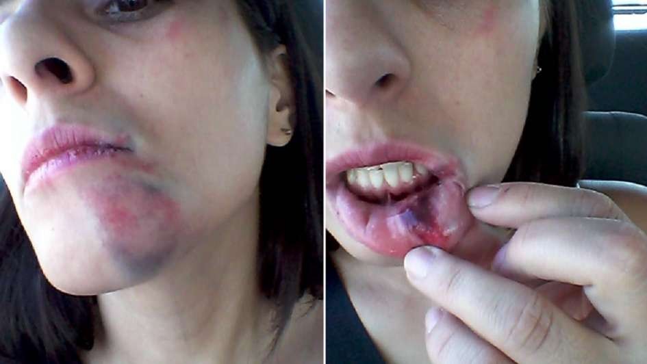 Así quedó Noelia por negarse a darle un beso a un vecino | Actualidad