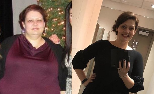 La mujer que adelgazó 70 kilos con sólo tres tips de su nutricionista | Curiosidades