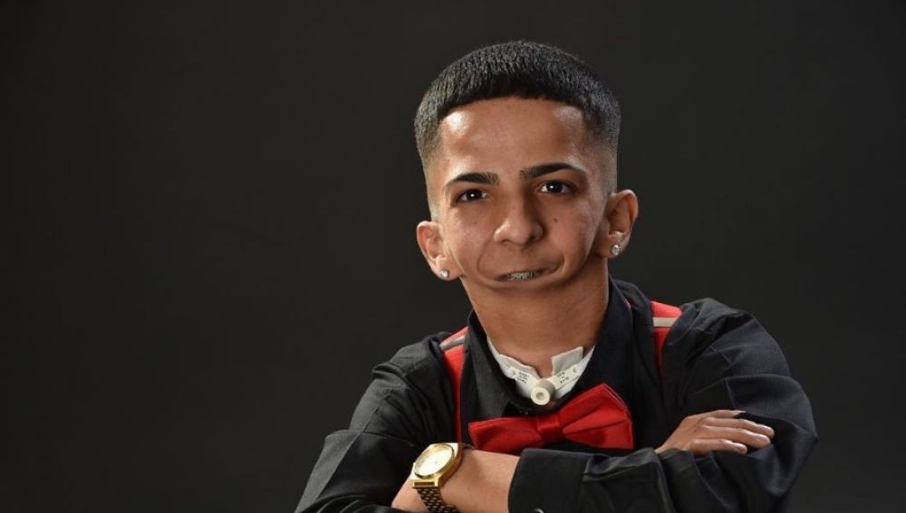 La historia del rapero sin mandíbula | Curiosidades