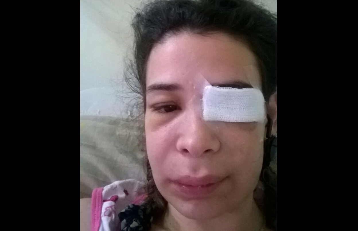 Su expareja policía le sacó un ojo y sigue amenazándola: “Vivo con miedo todo el tiempo" | Actualidad