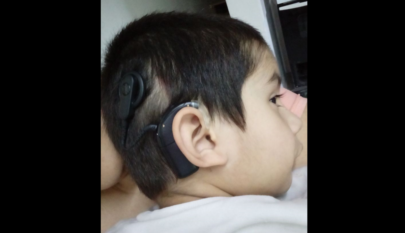 Un nene hipoacúsico de 4 años necesita ayuda para comprar un audífono | Actualidad