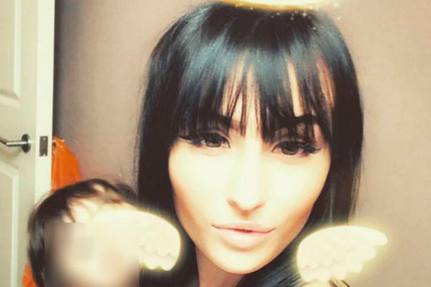 Se tiñó el pelo para su cumpleaños y terminó con la cara desfigurada por una reacción alérgica | Curiosidades