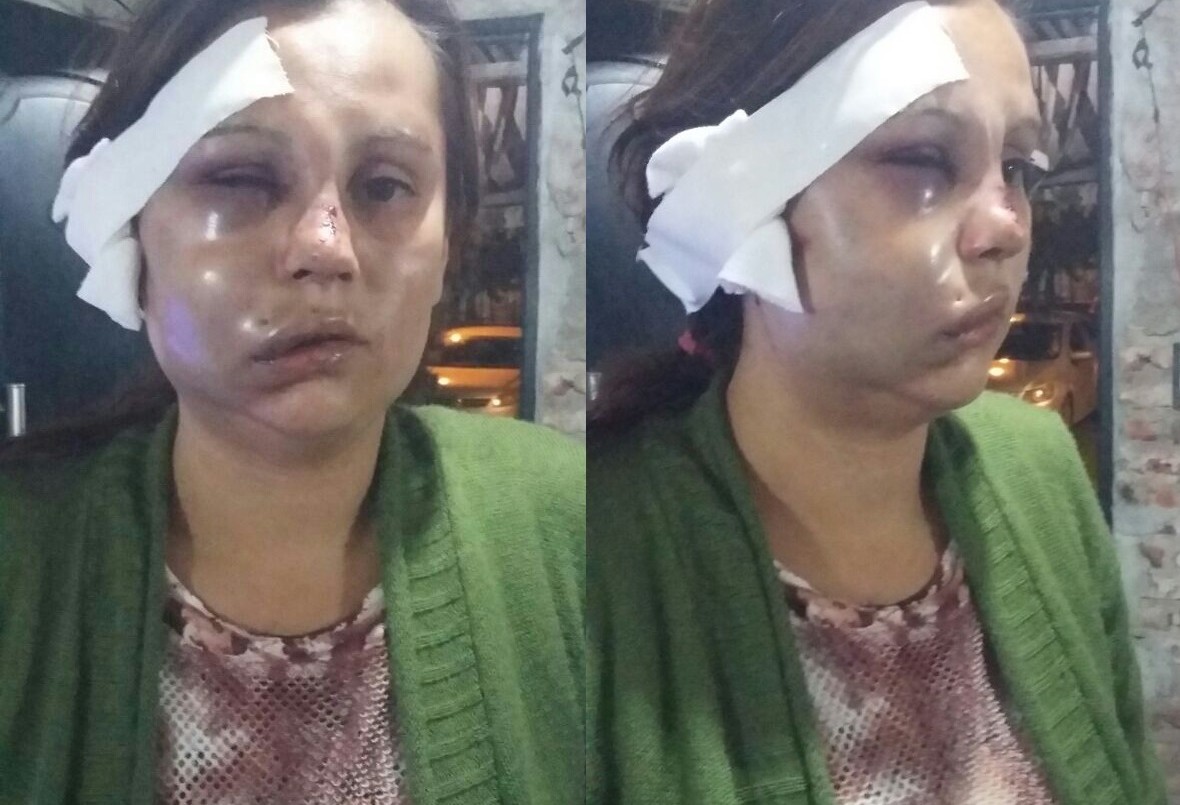 Denunció que su pareja la golpeó y escapó | Actualidad