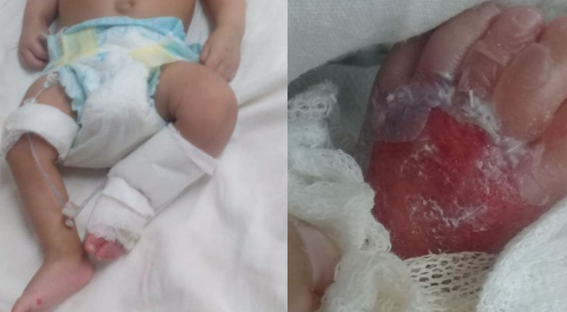 Denuncian que un bebé con un tumor en la cabeza fue quemado en un hospital de Moreno | Actualidad