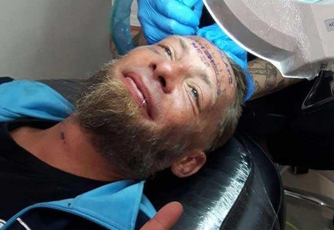 Indignación viral: tatuaron en la cara a un indigente durante una despedida de solteros | Redes