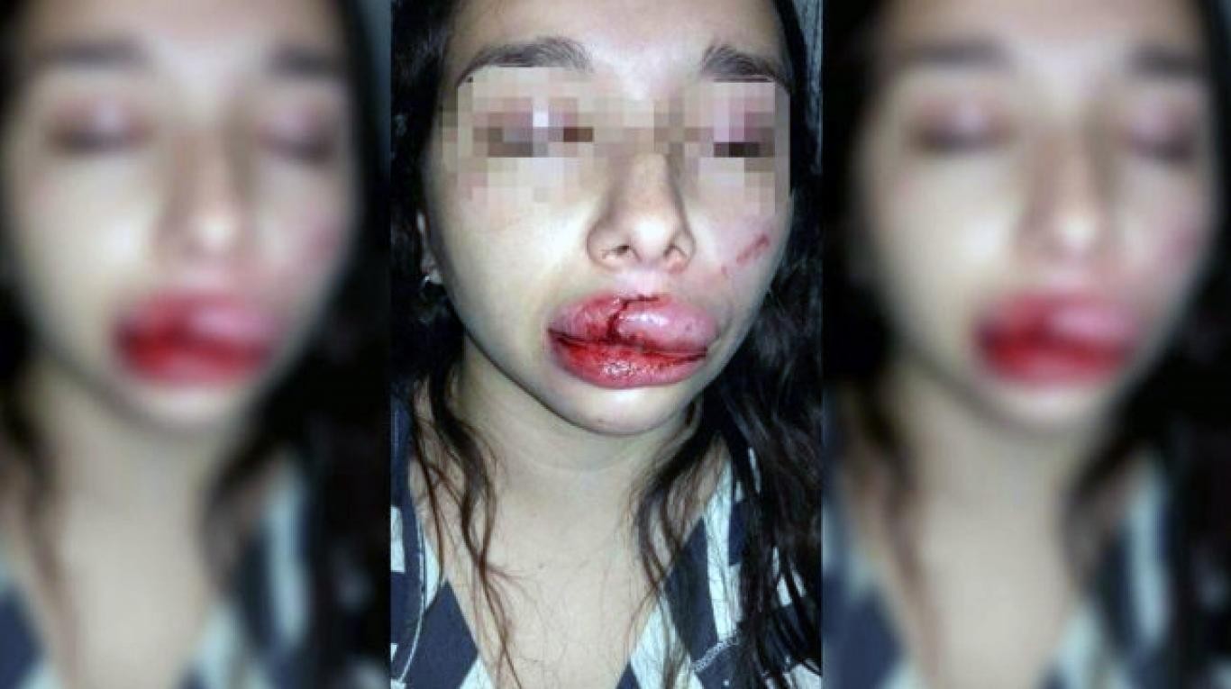 Santiago del Estero: tres hombres intentaron violarla y le desfiguraron la cara con un hierro | Actualidad