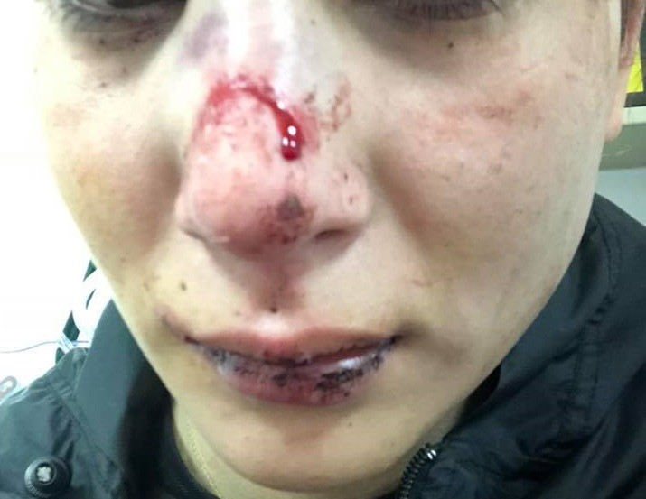 Denunció que su exnovio le dio una paliza en la calle: "Espero poder volver a sonreír" | Actualidad