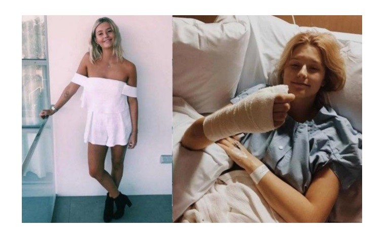 Le amputaron un dedo por comerse las uñas durante años | Internacionales