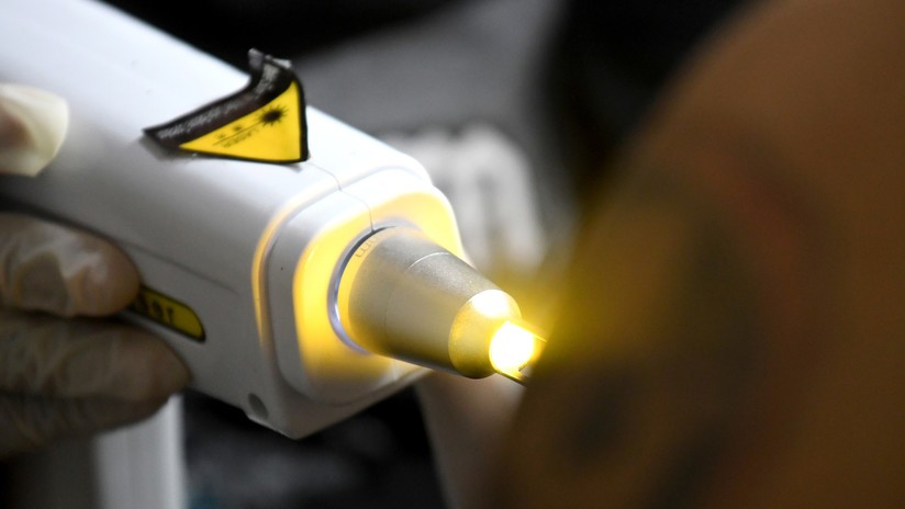 Video: quiso quitarse un tatuaje con las iniciales de su exesposa y obtuvo un horrible resultado | Redes