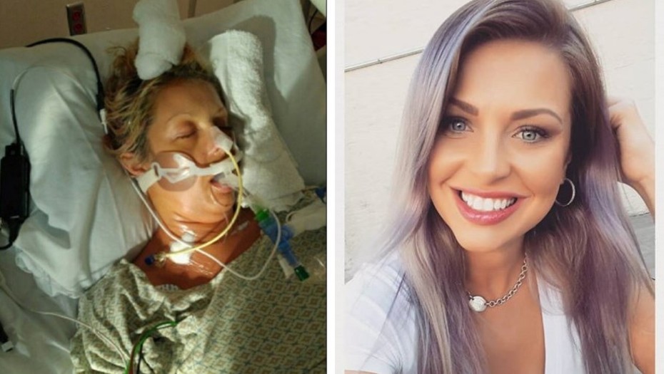 Una mujer se sentía cansada, pensó que era estrés y estuvo al borde de la muerte | Curiosidades