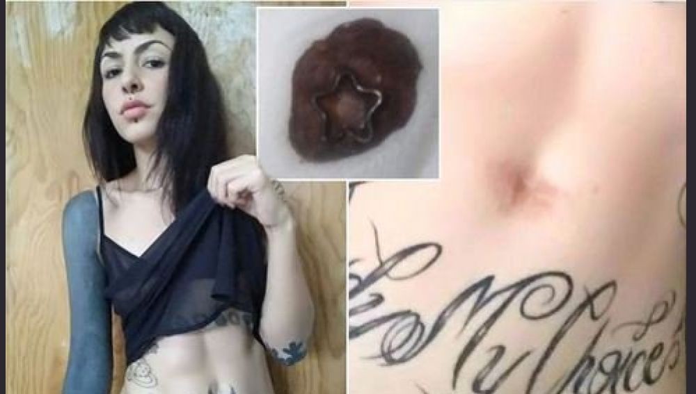 La joven que se sacó el ombligo y se lo regaló a su novio | Curiosidades