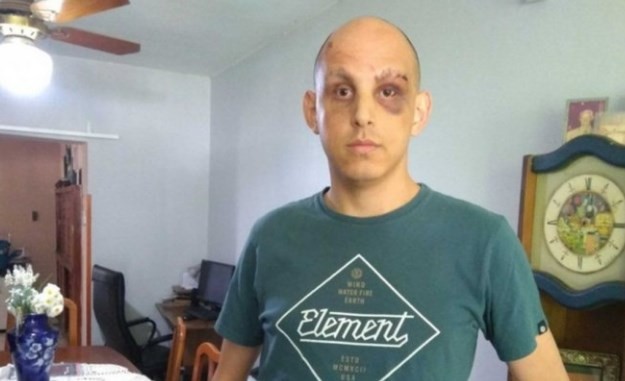 Brutal golpiza a un joven por ser gay en un boliche de Ramallo | Actualidad