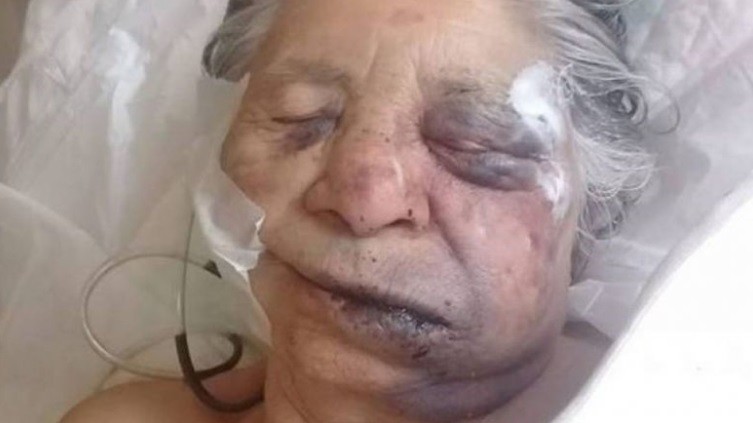 Brutal entradera en Santa Fe: delincuentes desfiguraron a una abuela de 84 años | Actualidad