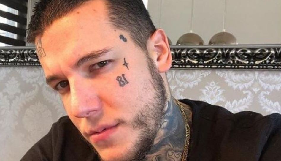 La foto de Alex Caniggia después de su operación de nariz | Espectáculos