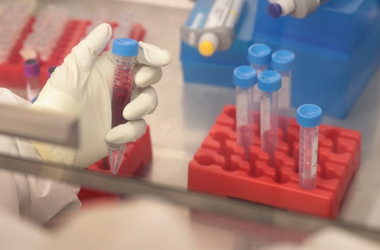 Descubren una fórmula para eliminar el virus del sida | Actualidad