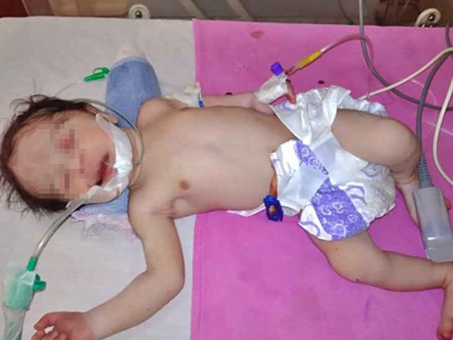 India: una mujer dio a luz al mismo tiempo que se quitaba la vida | Internacionales