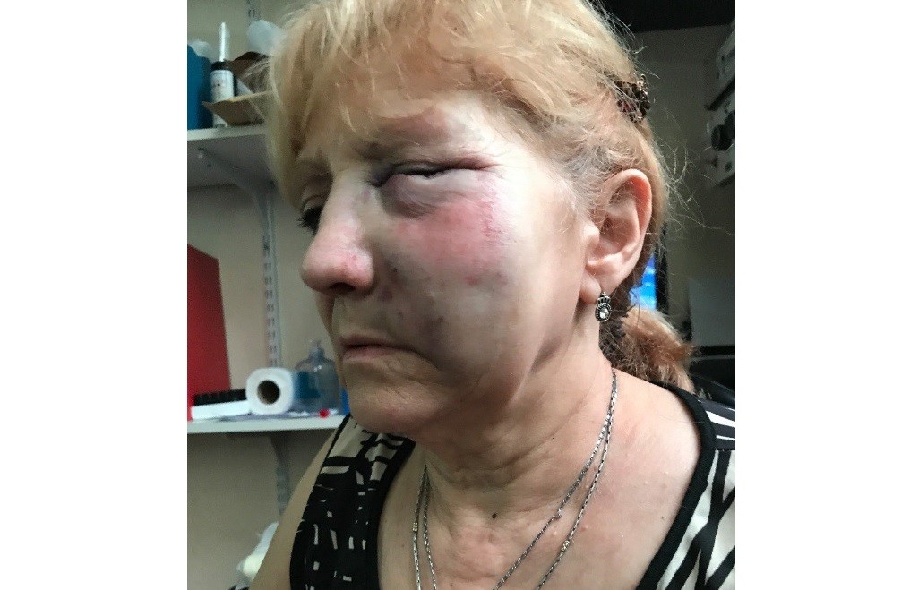 Motochorros golpearon y arrastraron a una mujer de 68 años en Morón | Actualidad