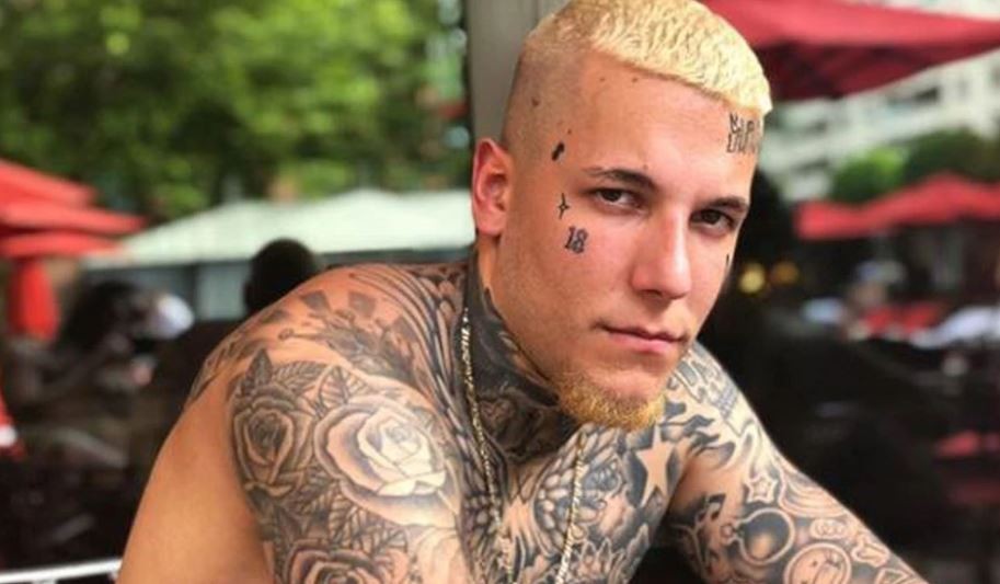 Fotos: así le quedó la cara a Alex Caniggia tras su operación de nariz | Espectáculos