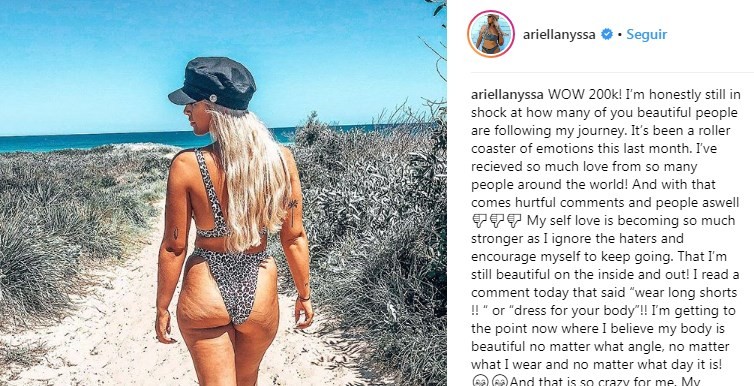 La modelo que se volvió viral por mostrar sus estrías y celulitis al natural | Curiosidades