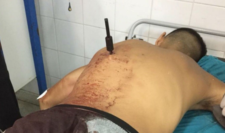 Robó, una mujer lo corrió y lo acuchilló por al espalda | Actualidad