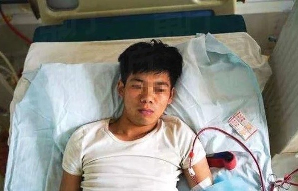 Vendió un riñón para comprar un iPhone y ahora quedó discapacitado de por vida | Curiosidades