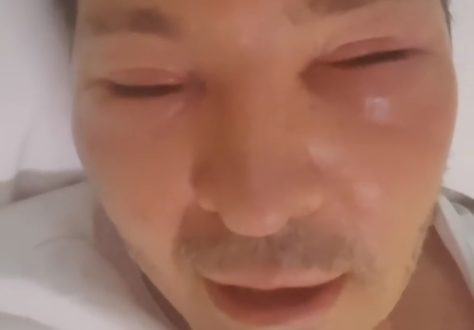 El drama de Guido Suller: está internado con la cara desfigurada | Espectáculos