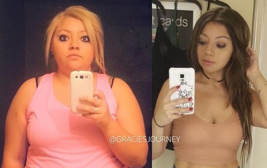 La joven que bajó 50 kilos y ahora difunde su mensaje de "vida sana" por Instagram | Curiosidades
