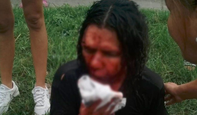 Tucumán: un hombre fue atacado a ladrillazos por ser gay | Actualidad