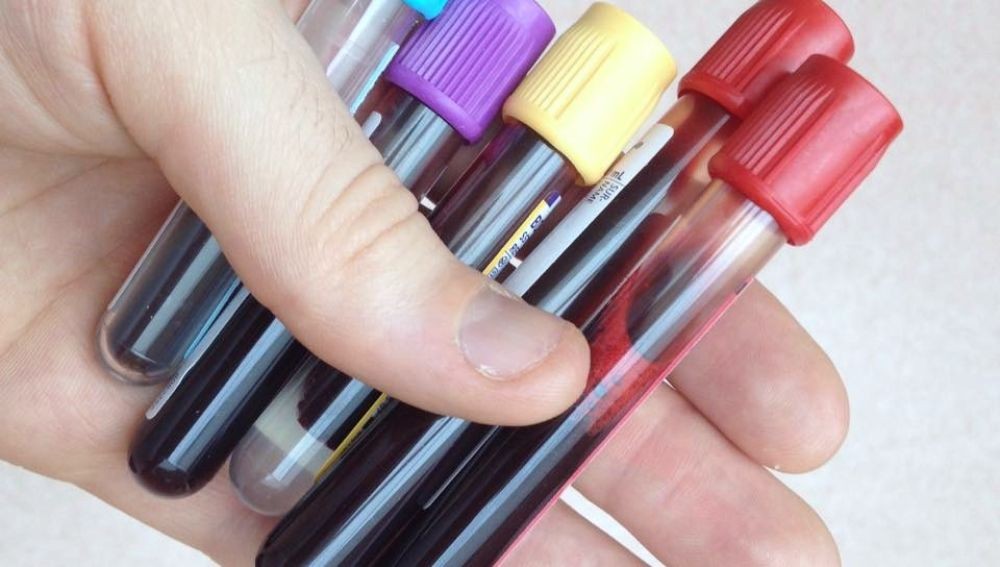 Le sacaba medio litro de sange a su hijo por semana y la tiraba al inodoro | Internacionales