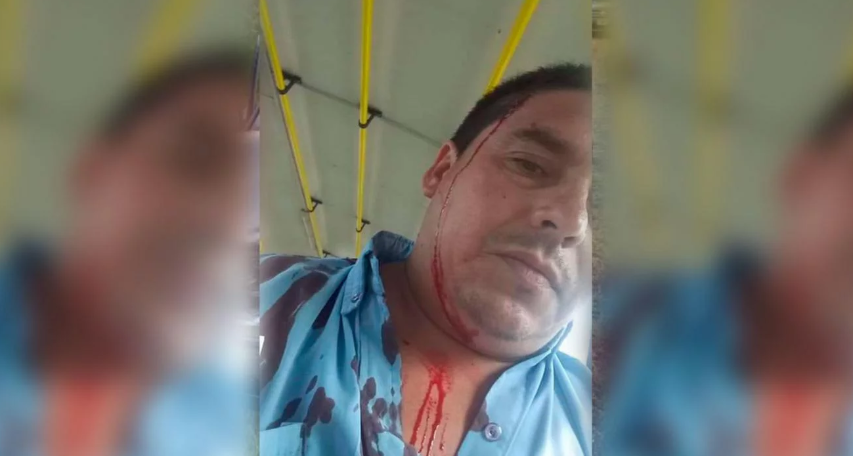 Un colectivero fue baleado con una escopeta en Moreno | Actualidad