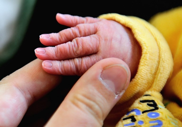 "Milagro": médicos se defienden tras declarar muerto a un bebé que estaba vivo | Internacionales