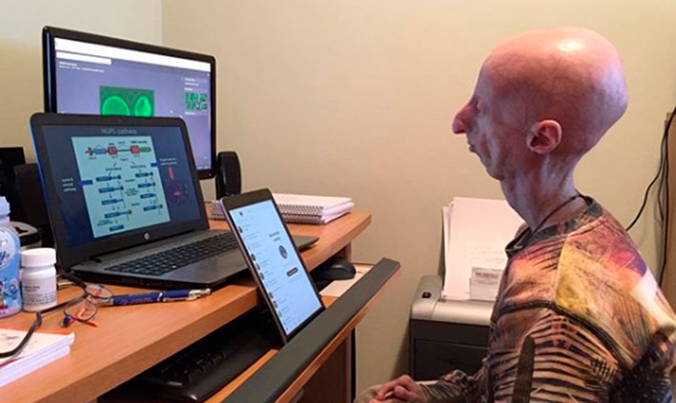 El biólogo que sufre de envejecimiento prematuro y busca una cura para su enfermedad | Internacionales