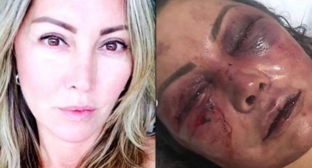 Se conocieron por redes y en la primera cita le dio una brutal paliza: golpes y mordiscos | Internacionales