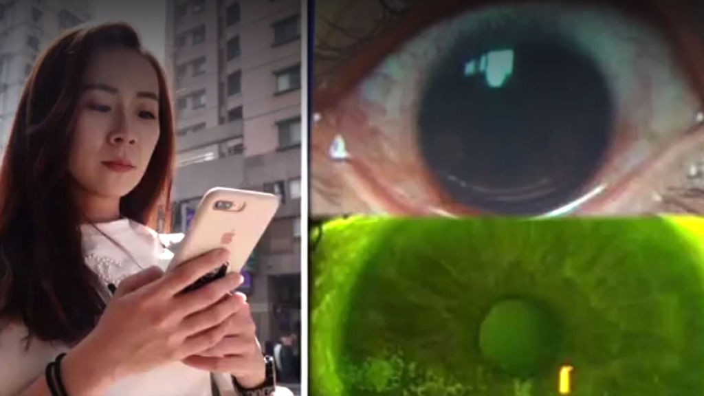 La joven que tiene 500 agujeros en la córnea por usar la pantalla del celular con el brillo al máximo | Curiosidades